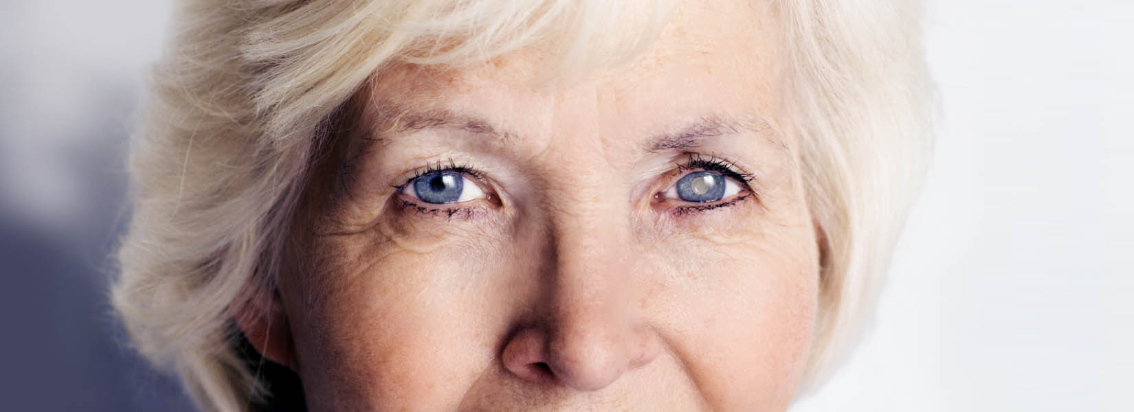 Cataract Surgery in Blythewood